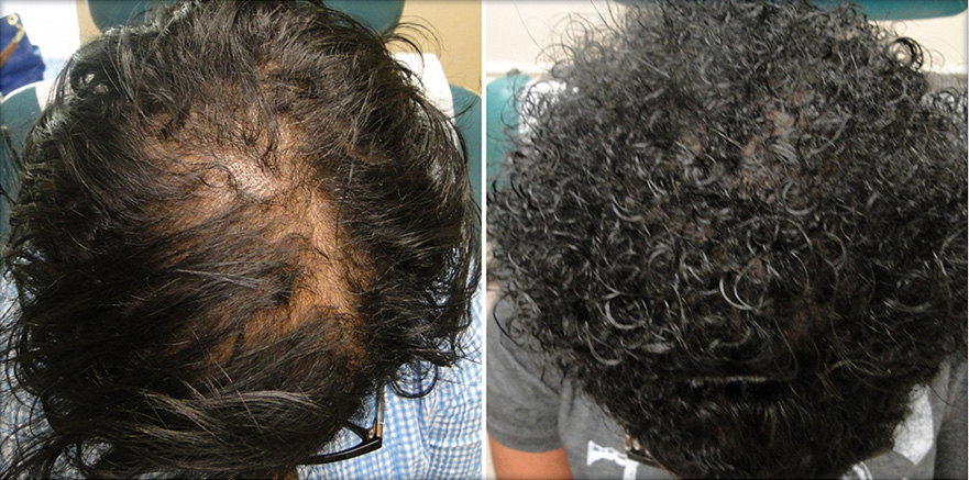 Click here to see stunning before & after photos of Non-Surgical Therapy.